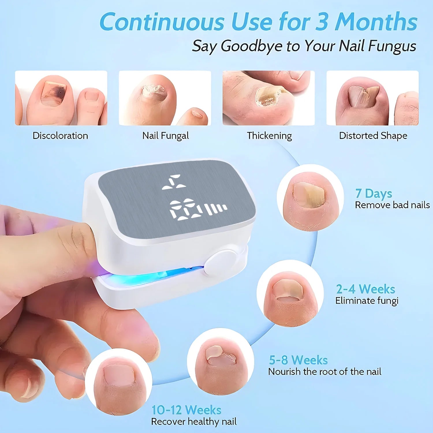 Nail Fungus Cleaning Laser Device Foot Nail Care Tools